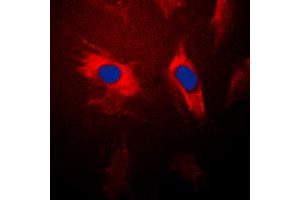 Immunofluorescent analysis of 14-3-3 theta staining in HeLa cells.