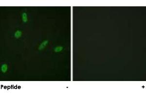 Immunofluorescence analysis of HeLa cells, using ETS1 polyclonal antibody . (ETS1 抗体)