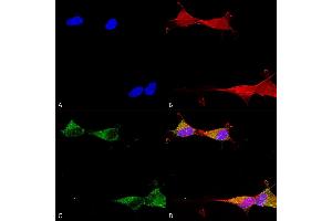 Immunocytochemistry/Immunofluorescence analysis using Mouse Anti-Ataxin 1 Monoclonal Antibody, Clone S65-37 (ABIN1741521). (Ataxin 1 抗体  (AA 746-761))