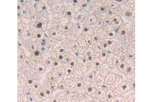 Used in DAB staining on fromalin fixed paraffin- embedded liver tissue (MECP2 抗体  (AA 1-177))