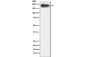 Western blot analysis of MYH7B expression in Human fetal muscle lysate.