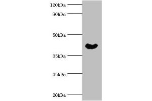 Western blot All lanes: Cytoplasmic protein NCK1 antibody at 4 μg/mL + Rat liver tissue Secondary Goat polyclonal to rabbit IgG at 1/10000 dilution Predicted band size: 43, 36 kDa Observed band size: 43 kDa (NCK1 抗体  (AA 58-377))