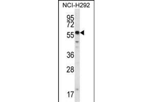 Western Blotting (WB) image for anti-SET and MYND Domain Containing 2a (SMYD2A) (AA 120-152), (N-Term) antibody (ABIN387897)