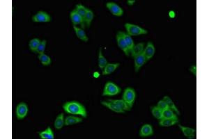 Immunofluorescent analysis of HepG2 cells using ABIN7160827 at dilution of 1:100 and Alexa Fluor 488-congugated AffiniPure Goat Anti-Rabbit IgG(H+L) (NLRP3 抗体  (AA 30-102))