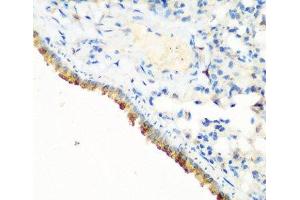 Immunohistochemistry of paraffin-embedded Mouse lung using CBL Polyclonal Antibody at dilution of 1:200 (40x lens). (CBL 抗体)