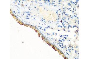 Immunohistochemistry of paraffin-embedded Mouse lung using CBL Polyclonal Antibody at dilution of 1:200 (40x lens). (CBL 抗体)