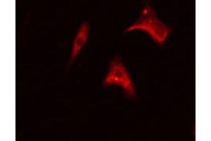 ABIN6267366 staining Hela cells by IF/ICC. (BCR 抗体  (pTyr177))