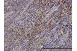 Image no. 1 for anti-RAS Guanyl Releasing Protein 4 (RASGRP4) (AA 574-674) antibody (ABIN599321) (RASGRP4 抗体  (AA 574-674))