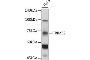Western blot analysis of extracts of HeLa cells, using TRIM32 antibody (ABIN6132735, ABIN6149520, ABIN6149521 and ABIN6222878) at 1:500 dilution. (TRIM32 抗体  (AA 1-280))