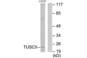 Western blot analysis of extracts from LOVO cells, using TUSC5 antibody. (TUSC5 抗体)