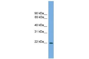 WB Suggested Anti-Jundm2 Antibody Titration:  0. (JDP2 抗体  (N-Term))