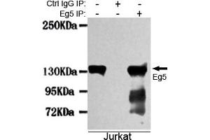 Immunoprecipitation analysis of Jurkat cell lysates using Eg5 mouse mAb. (KIF11 抗体)