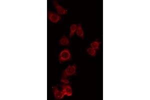ABIN6274971 staining RAW264. (CPN1 抗体  (C-Term))