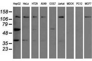 Western blot analysis of extracts (35 µg) from 9 different cell lines by using anti-IGF2BP2 monoclonal antibody. (IGF2BP2 抗体)