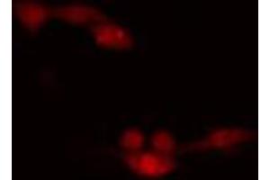 ABIN6266648 staining HeLa cells by IF/ICC. (CDK7 抗体  (Internal Region))
