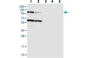 Western blot analysis of Lane 1: RT-4, Lane 2: U-251 MG, Lane 3: Human Plasma, Lane 4: Liver, Lane 5: Tonsil with USP6NL polyclonal antibody . (USP6NL 抗体)