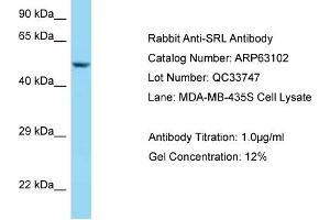 Western Blotting (WB) image for anti-Sarcalumenin (SRL) (C-Term) antibody (ABIN2789371) (Sarcalumenin 抗体  (C-Term))