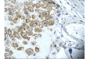 Rabbit Anti-ENO1 Antibody       Paraffin Embedded Tissue:  Human placenta cell   Cellular Data:  Epithelial cells of renal tubule  Antibody Concentration:   4. (ENO1 抗体  (Middle Region))