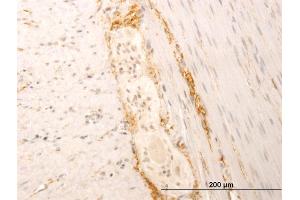 Immunoperoxidase of monoclonal antibody to SYT1 on formalin-fixed paraffin-embedded human smooth muscle. (SYT1 抗体  (AA 1-422))