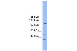 Western Blot showing STARD8 antibody used at a concentration of 1. (STARD8 抗体  (N-Term))