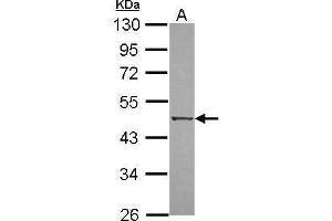 WB Image Sample (30 ug of whole cell lysate) A: A549 10% SDS PAGE antibody diluted at 1:500 (DAPK3 抗体  (N-Term))