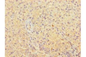 Immunohistochemistry (IHC) image for anti-Obg-Like ATPase 1 (OLA1) (AA 1-396) antibody (ABIN7162111)