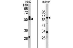 (LEFT) Western blot analysis of HMGCS1 antibody (Center) in HL60 cell line lysates (35ug/lane). (HMGCS1 抗体  (Middle Region))