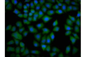 Immunofluorescence staining of Hela cells with ABIN7149364 at 1:133, counter-stained with DAPI. (CKAP4 抗体  (AA 260-394))