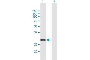 Western Blotting (WB) image for anti-Cbp/p300-Interacting Transactivator, with Glu/Asp-Rich Carboxy-terminal Domain, 2 (CITED2) (AA 1-270) antibody (ABIN948933)