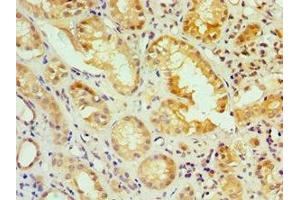 Immunohistochemistry of paraffin-embedded human kidney tissue using ABIN7156617 at dilution of 1:100 (IRF2 抗体  (AA 120-349))