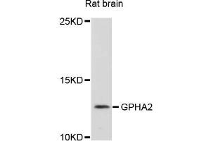 Western blot analysis of extracts of rat brain cells, using GPHA2 antibody. (GPHa2 抗体)