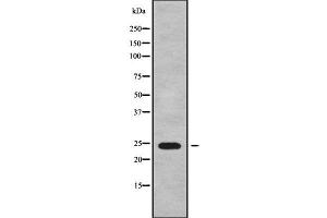 Western blot analysis of MRPS26 using Jurkat whole cell lysates (MRPS26 抗体  (Internal Region))