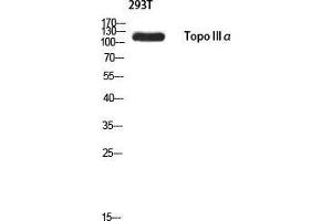 Western Blot (WB) analysis of 293T using Topo IIIalpha antibody. (TOP3A 抗体)