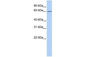 WB Suggested Anti-ACOT12 Antibody Titration: 0. (ACOT12 抗体  (Middle Region))
