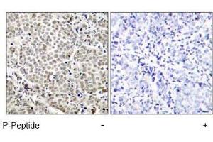 Image no. 1 for anti-Nuclear Factor-kB p65 (NFkBP65) (pSer529) antibody (ABIN196955) (NF-kB p65 抗体  (pSer529))