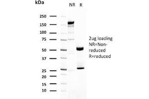 SDS-PAGE Analysis Purified Uroplakin 1A Mouse Monoclonal Antibody (UPK1A/2921). (UPK1A 抗体  (AA 114-173))