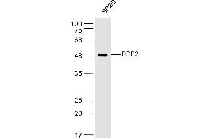 SP2/0 lysates probed with DDB2 Polyclonal Antibody, Unconjugated  at 1:500 dilution and 4˚C overnight incubation. (DDB2 抗体  (AA 201-300))