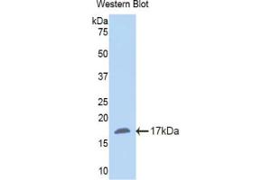 Western blot analysis of the recombinant protein. (NNMT 抗体  (AA 127-249))