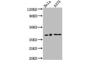 Western Blot Positive WB detected in: Hela whole cell lysate, A375 whole cell lysate All lanes: EDG2 antibody at 1:1000 Secondary Goat polyclonal to rabbit IgG at 1/50000 dilution Predicted band size: 42, 42 kDa Observed band size: 42 kDa (Recombinant LPAR1 抗体)