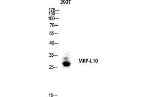 Western Blot (WB) analysis of 293T lysis using MRP-L10 antibody. (MRPL10 抗体  (C-Term))
