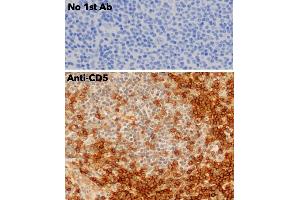 Immunohistochemistry (IHC) image for anti-CD5 (CD5) (AA 105-210) antibody (ABIN7272988) (CD5 抗体  (AA 105-210))