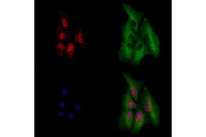 ABIN6264185 and ABIN6279642 staining  cells by IF/ICC. (PHOX2B 抗体  (Internal Region))