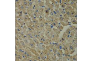 Immunohistochemistry of paraffin-embedded mouse heart using CCBL1 antibody (ABIN5973926) at dilution of 1/100 (40x lens). (CCBL1 抗体)