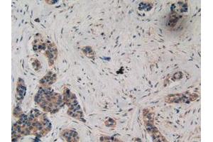 Detection of ATXN1 in Human Breast Tissue using Polyclonal Antibody to Ataxin 1 (ATXN1) (Ataxin 1 抗体  (AA 569-807))