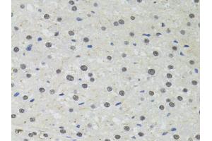 Immunohistochemistry of paraffin-embedded rat liver using PPP4C antibody. (PPP4C 抗体)