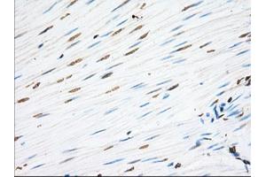 Immunohistochemical staining of paraffin-embedded Human Kidney tissue using anti-EIF2S1 mouse monoclonal antibody. (EIF2S1 抗体)