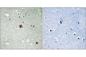 Immunohistochemistry (IHC) image for anti-Topoisomerase (DNA) II alpha 170kDa (TOP2A) (AA 1482-1531), (pSer1525) antibody (ABIN1532176)