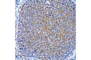 Immunohistochemistry of paraffin-embedded rat ovary using MAP1LC3A antibody. (MAP1LC3A 抗体)