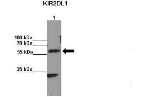 Immunoprecipitation (IP) image for anti-Killer Cell Immunoglobulin-Like Receptor, Two Domains, Long Cytoplasmic Tail, 1 (KIR2DL1) (C-Term) antibody (ABIN2789507)
