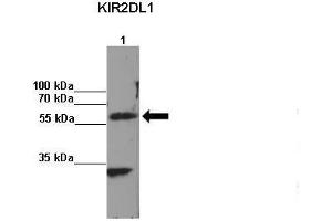 Amount and Sample Type: Lane 1:2x107 KIR2DL1 transfected NKL cells IP Antibody: KIR2DL1 Amount of IP Antibody: Primary Antibody: KIR2DL1 Primary Antibody Dilution: 1: x50Secondary Antibody: Anti-rabbit-HRP Secondary Antibody Dilution: 1:x0,000  Gene Name: KIR2DL1 Submitted by: Kerry S. (KIR2DL1 抗体  (C-Term))
